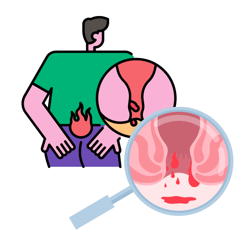 치질 자가진단, 초기 증상과 사진으로 헷갈리는 경우 | 메디핸드북