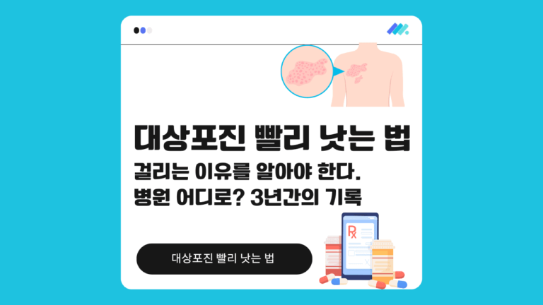 대상포진 빨리 낫는 법 썸네일