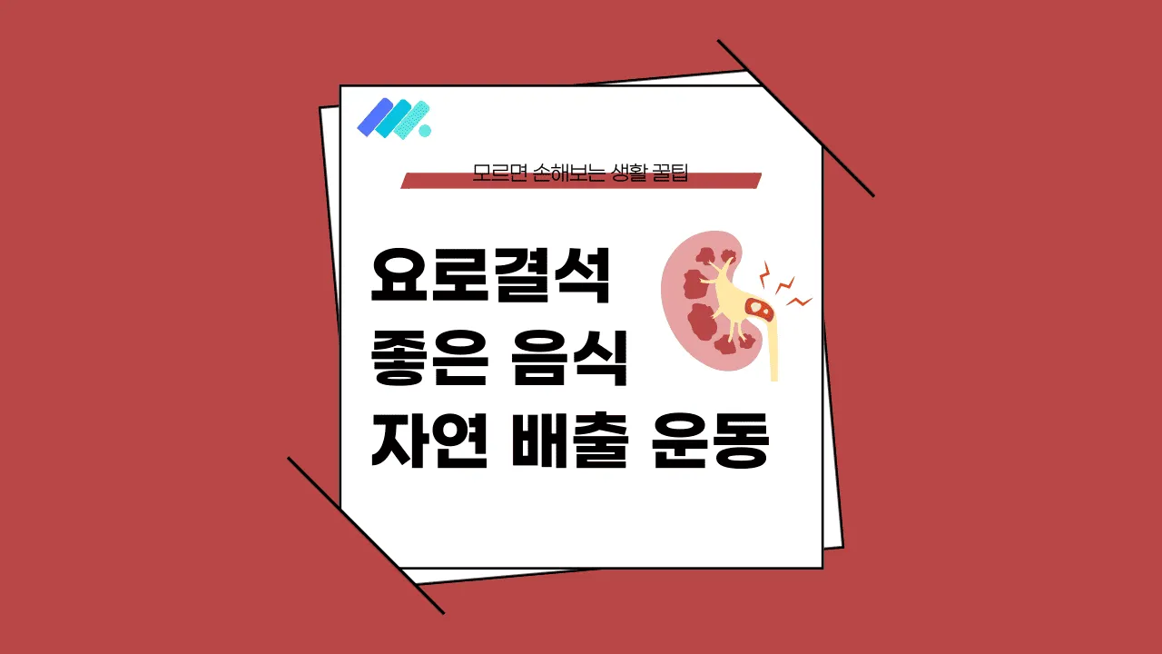 요로결석 자연배출 느낌 썸네일