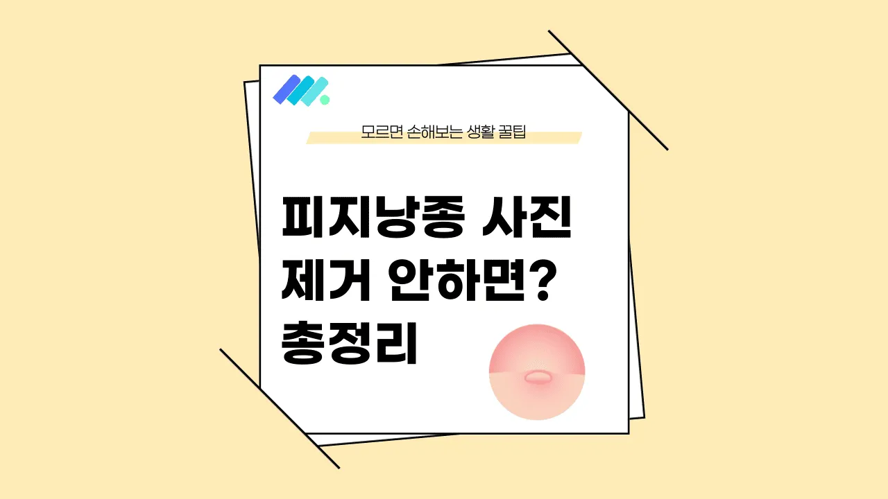 피지낭종 제거 안하면 썸네일
