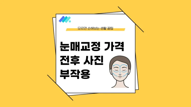 눈매교정 가격 썸네일