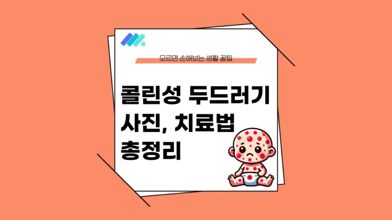 콜린성 두드러기 사진 썸네일