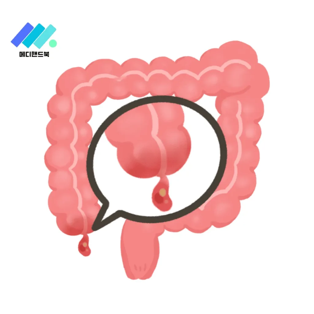 맹장염 증상, 자가 진단, 통증 위치 총정리! 예방이 불가능한 응급질환 - 메디핸드북