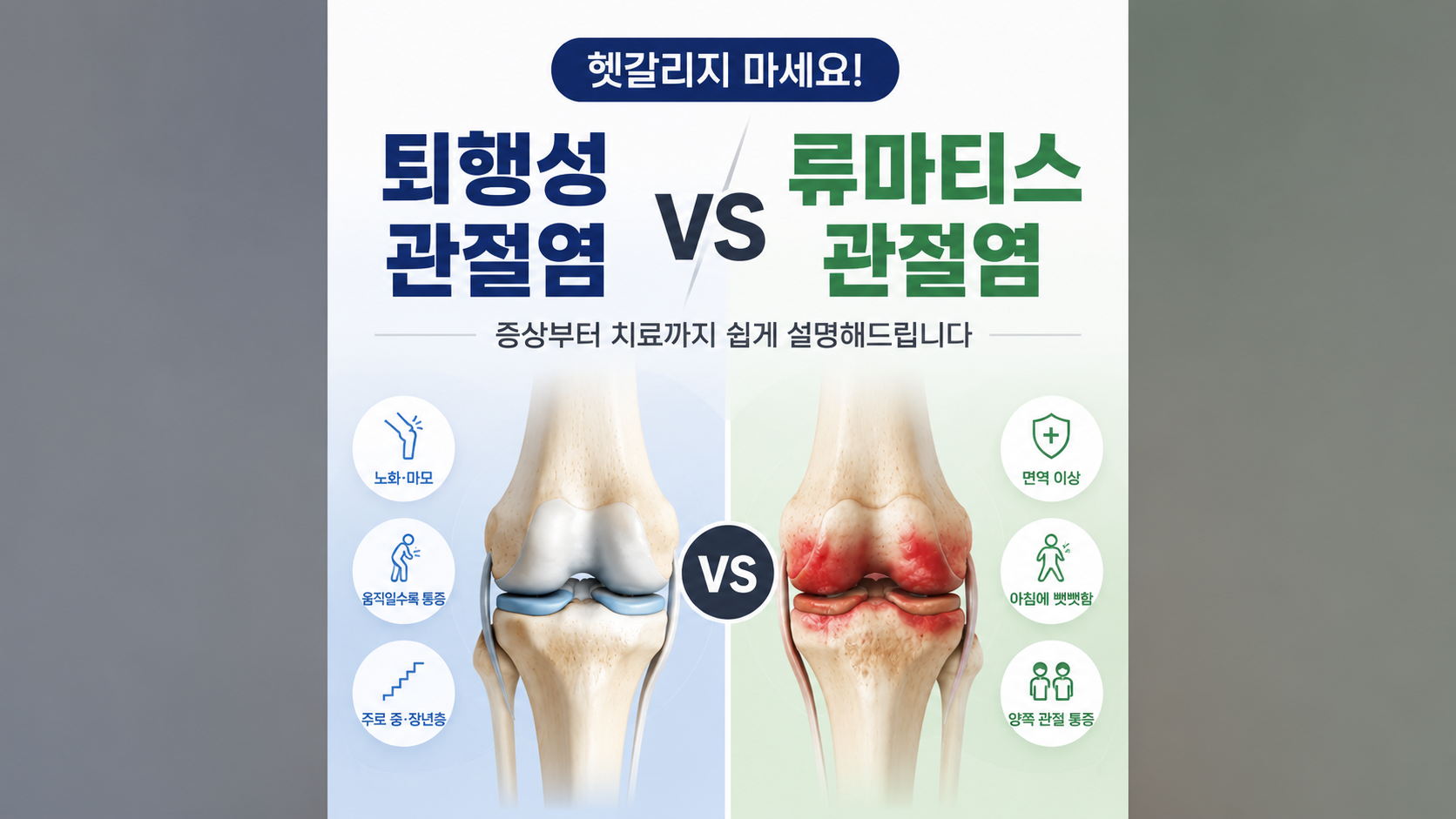 퇴행성 관절염 류마티스 관절염 썸네일