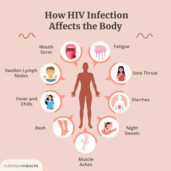HIV 감염이 몸에 미치는 영향을 설명하는 자료 이미지