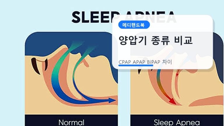 CPAP APAP BiPAP 양압기 종류 비교