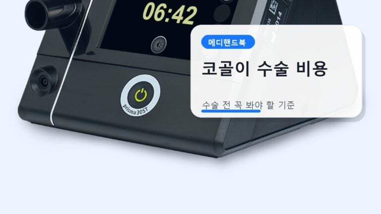 코골이 수술 비용과 검사 기준
